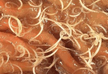 Whipworms in an intestine. From http://www.sciencebasedmedicine.org/tag/whipworms/.